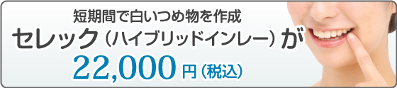 セレックAC導入のお知らせ